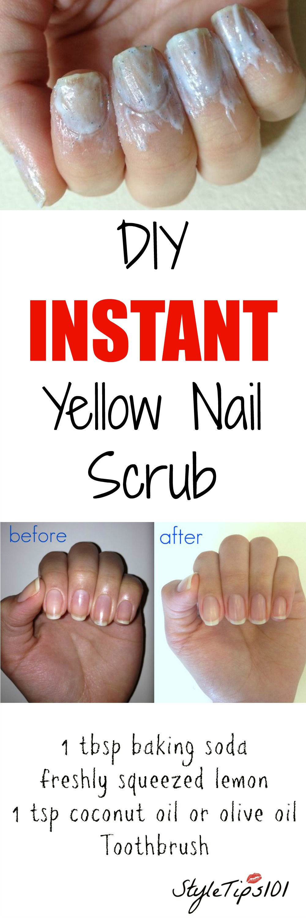 How to Remove Yellow Nails Stains