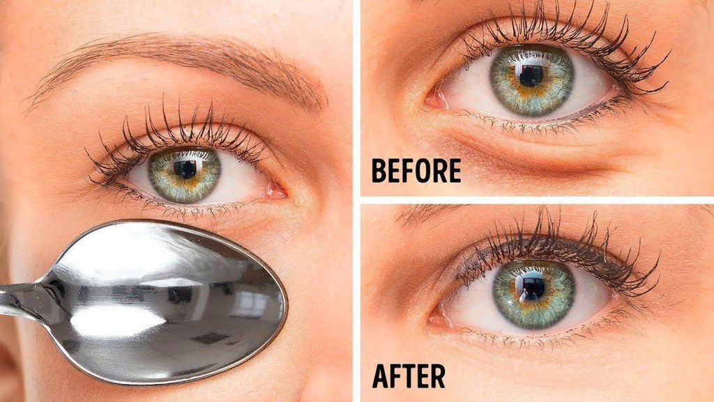 Cold Spoon Under Eyes DIY Beauty Hacks